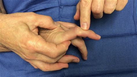 compression test by hand|extrinsic tightness hand test.